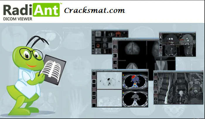 RadiANT DICOM Viewer Crack