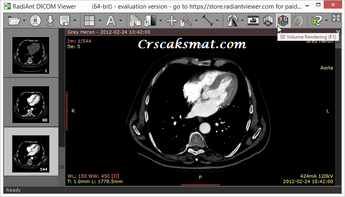 RadiANT DICOM Viewer Serial Number