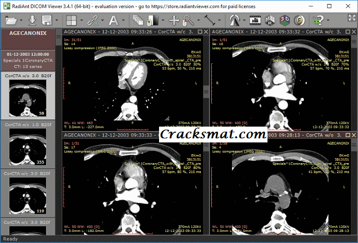 RadiANT DICOM Viewer Serial Number